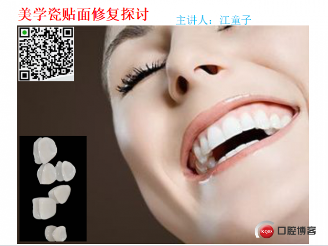 美学瓷贴面修复临床探讨1.png