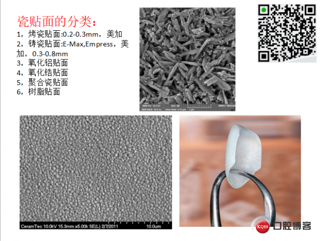 美学瓷贴面修复临床探讨2.png