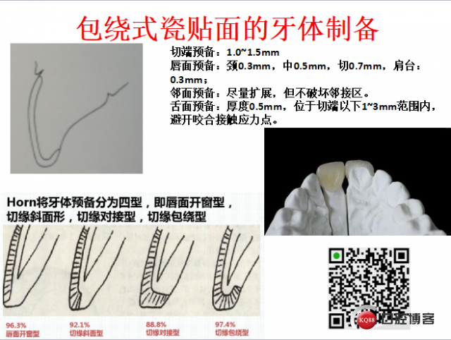 美学瓷贴面修复临床探讨8.png