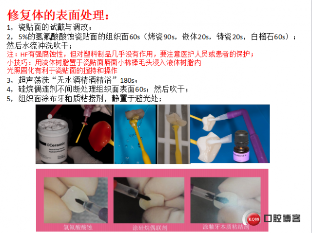美学瓷贴面修复临床探讨12.png