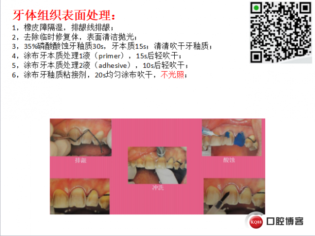 美学瓷贴面修复临床探讨13.png