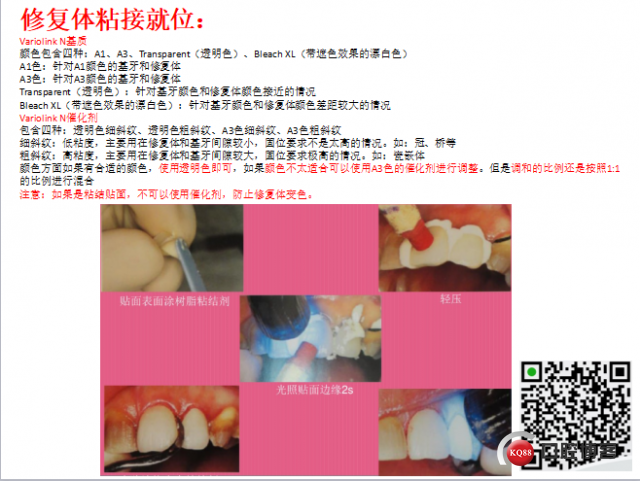美学瓷贴面修复临床探讨14.png