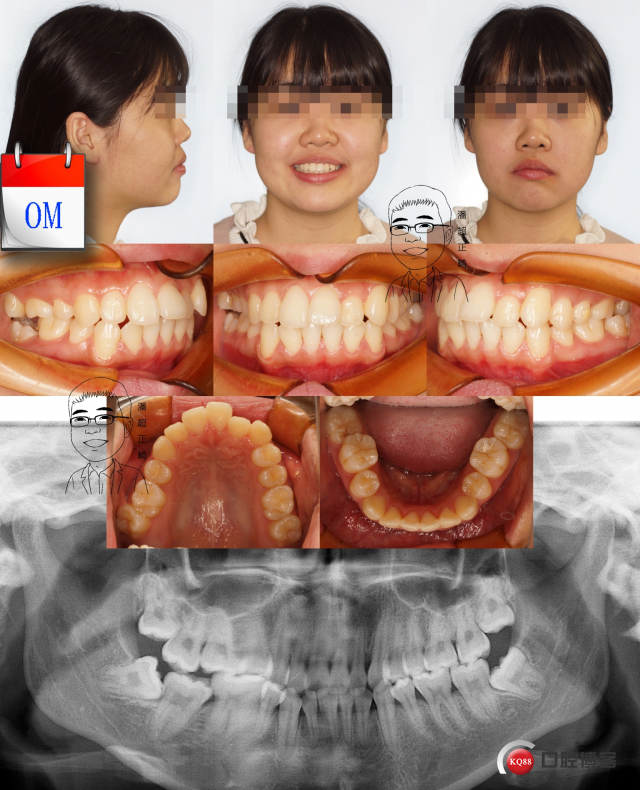 0msk_看图王.jpg