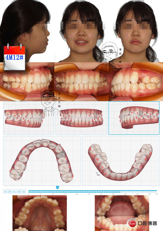 4m12#msk_看图王.jpg