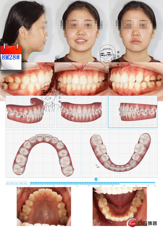 8m28#msk_看图王.jpg