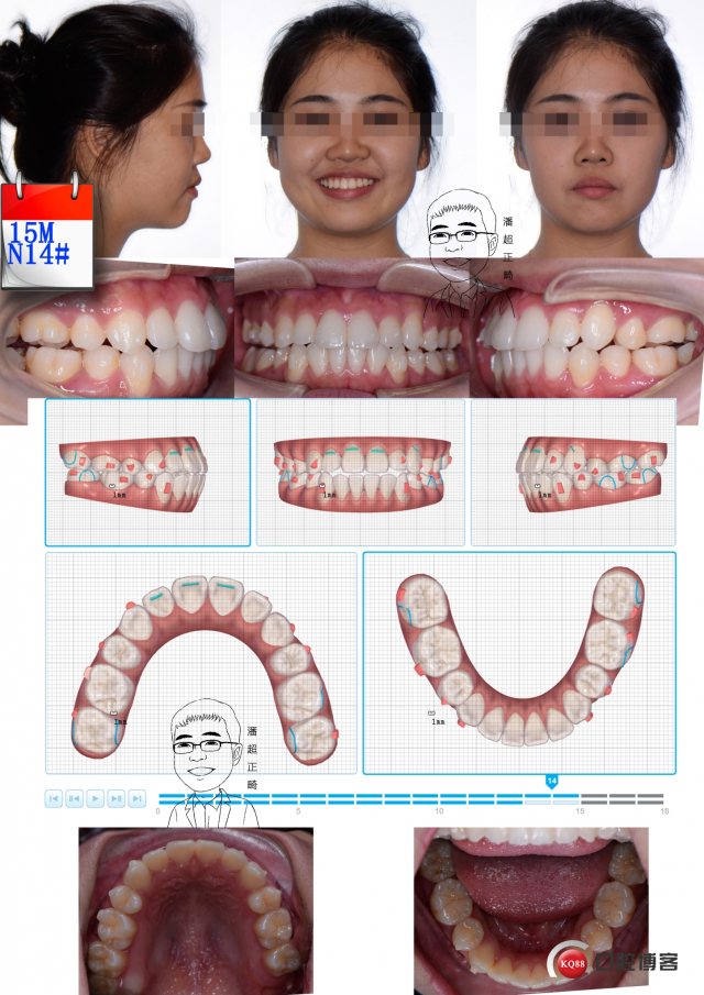 15mx14#msk_看图王.jpg