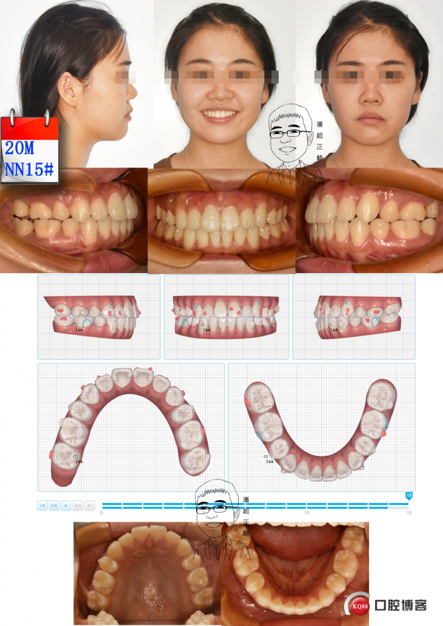 20，再新15#1msk_看图王.jpg