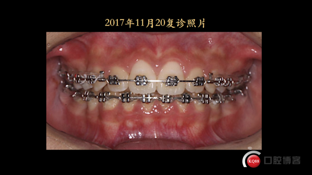 IMG_9980.PNG