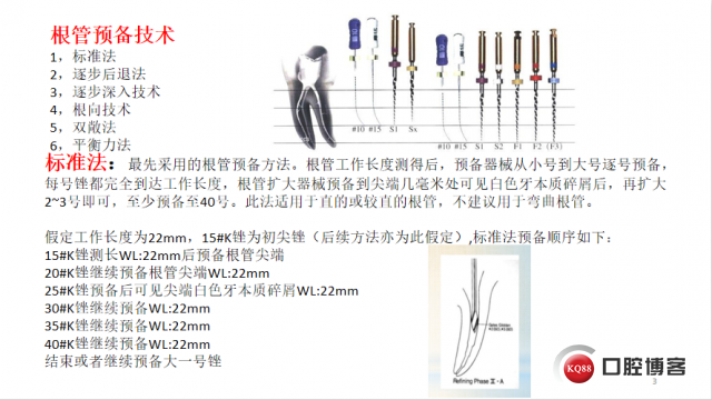 根管预备技术.png