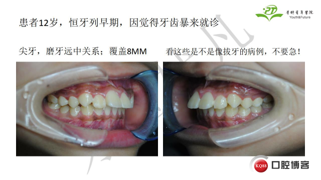 如何避免正畸陷阱！2.jpg_0004.jpg