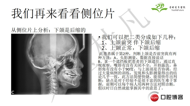 如何避免正畸陷阱！2.jpg_0005.jpg