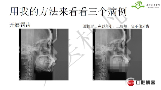 如何避免正畸陷阱！2.jpg_0006.jpg