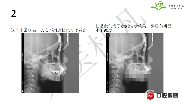如何避免正畸陷阱！2.jpg_0007.jpg