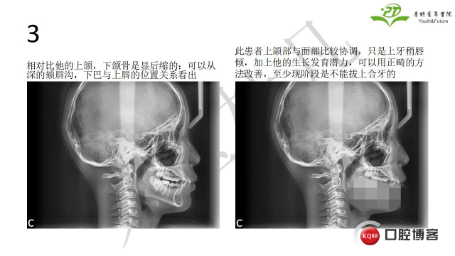 如何避免正畸陷阱！2.jpg_0008.jpg