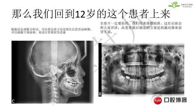 如何避免正畸陷阱！2.jpg_0009.jpg