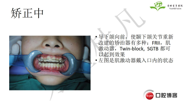 如何避免正畸陷阱！2.jpg_0010.jpg