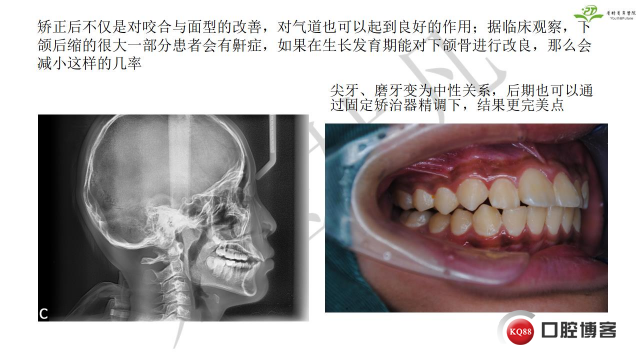如何避免正畸陷阱！2.jpg_0011.jpg