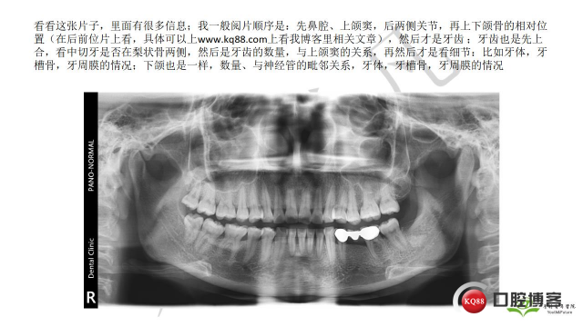 如何避免正畸陷阱！2.jpg_0014.jpg