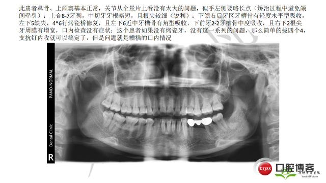 如何避免正畸陷阱！2.jpg_0015.jpg