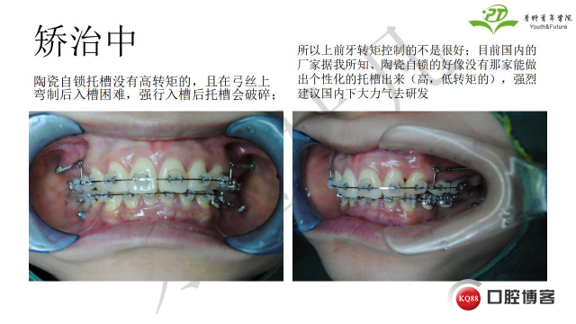 如何避免正畸陷阱！2.jpg_0018.jpg