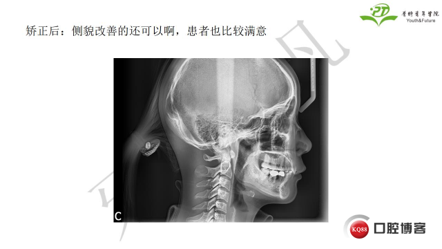 如何避免正畸陷阱！2.jpg_0019.jpg