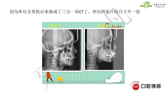 如何避免正畸陷阱！2.jpg_0020.jpg