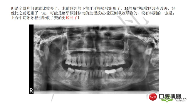 如何避免正畸陷阱！2.jpg_0021.jpg
