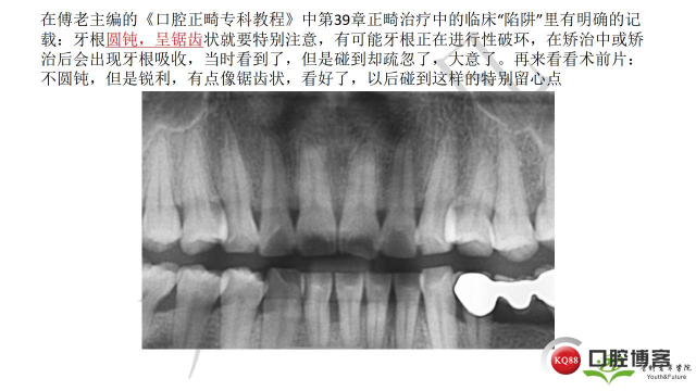 如何避免正畸陷阱！2.jpg_0022.jpg
