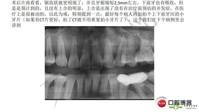 如何避免正畸陷阱！2.jpg_0023.jpg