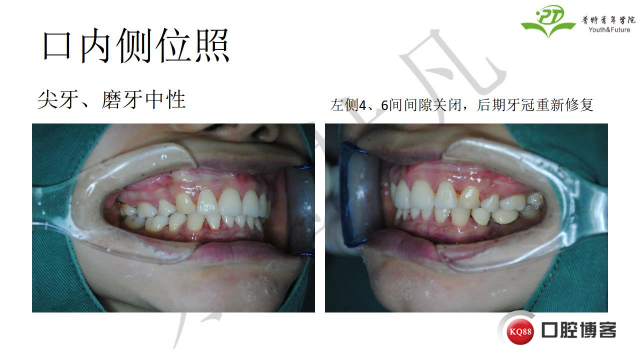 如何避免正畸陷阱！2.jpg_0025.jpg