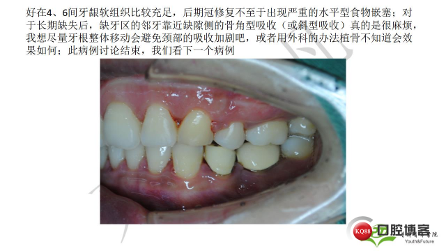 如何避免正畸陷阱！2.jpg_0026.jpg