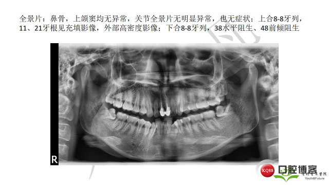 如何避免正畸陷阱！2.jpg_0028.jpg