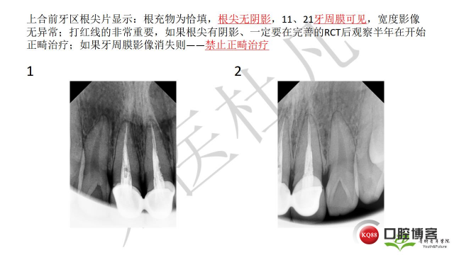 如何避免正畸陷阱！2.jpg_0029.jpg