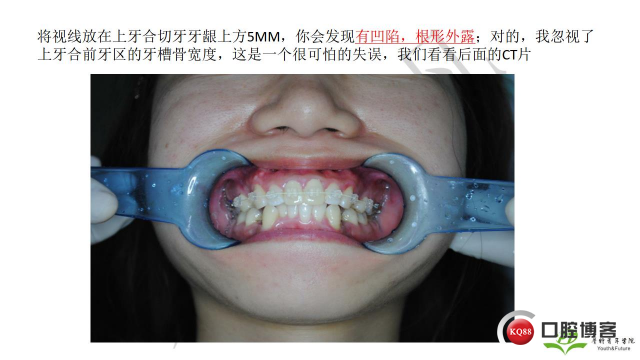 如何避免正畸陷阱！2.jpg_0034.jpg