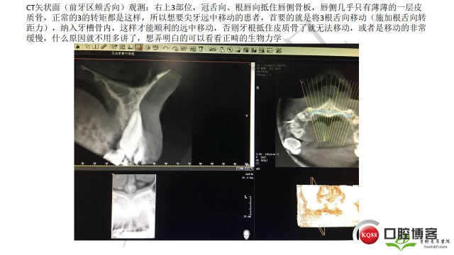 如何避免正畸陷阱！2.jpg_0035.jpg