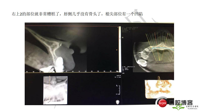 如何避免正畸陷阱！2.jpg_0036.jpg