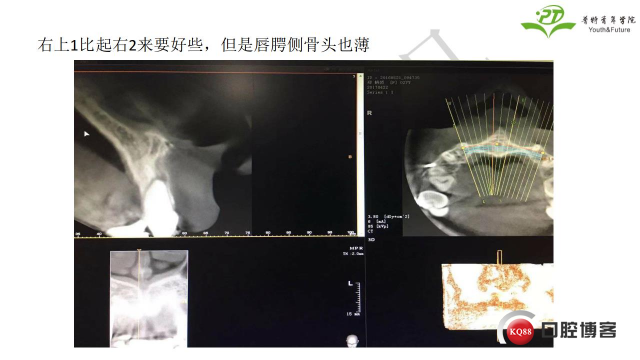 如何避免正畸陷阱！2.jpg_0037.jpg