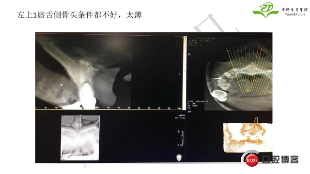 如何避免正畸陷阱！2.jpg_0038.jpg