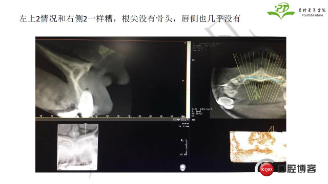 如何避免正畸陷阱！2.jpg_0039.jpg