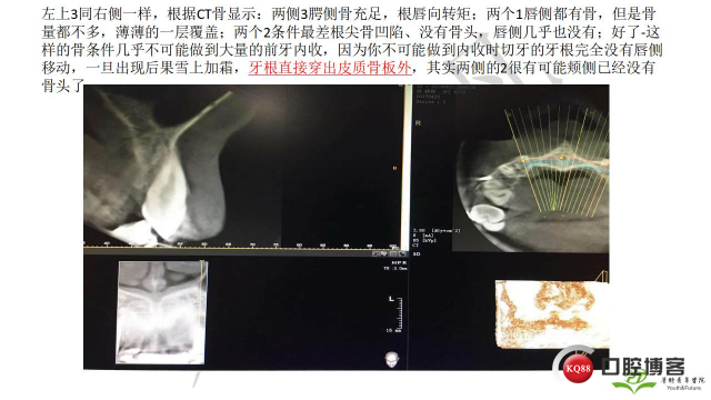 如何避免正畸陷阱！2.jpg_0040.jpg