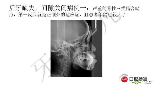 如何避免正畸陷阱！2.jpg_0043.jpg