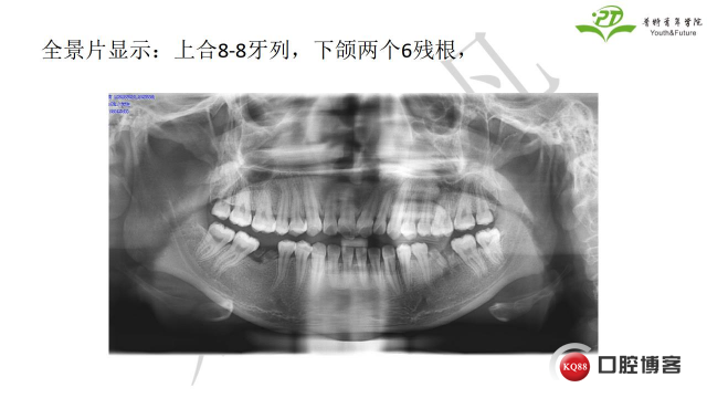 如何避免正畸陷阱！2.jpg_0044.jpg