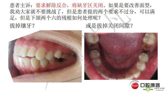如何避免正畸陷阱！2.jpg_0045.jpg