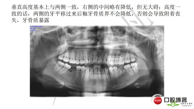 如何避免正畸陷阱！2.jpg_0047.jpg