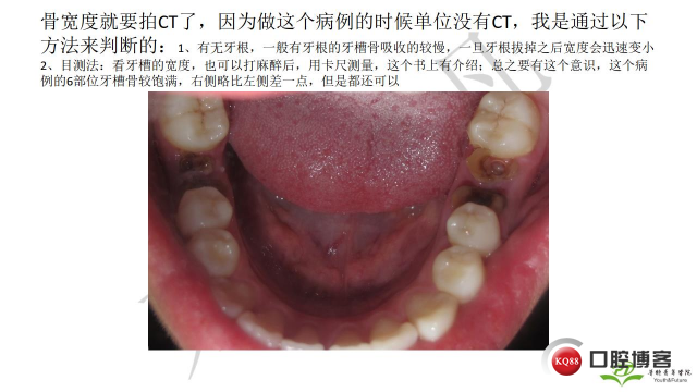 如何避免正畸陷阱！2.jpg_0048.jpg