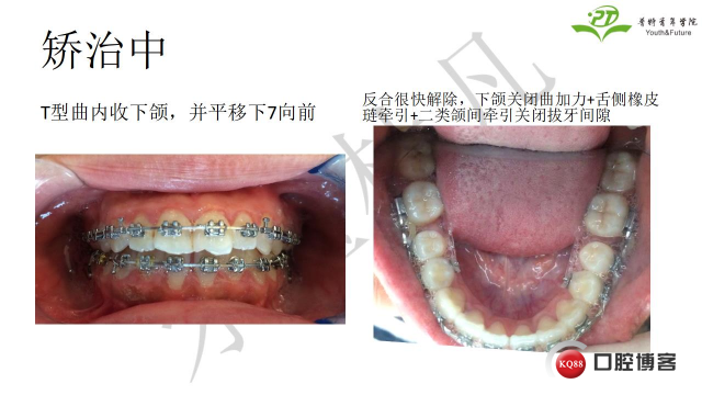 如何避免正畸陷阱！2.jpg_0049.jpg