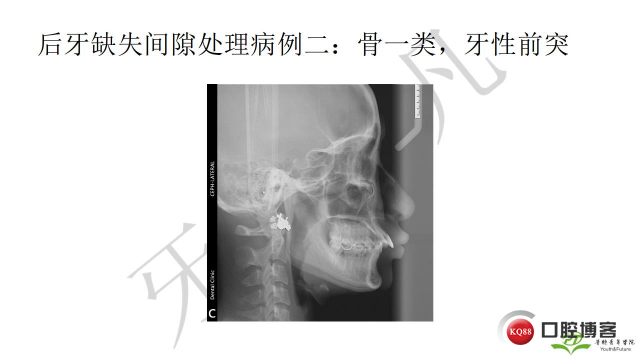 如何避免正畸陷阱！2.jpg_0052.jpg