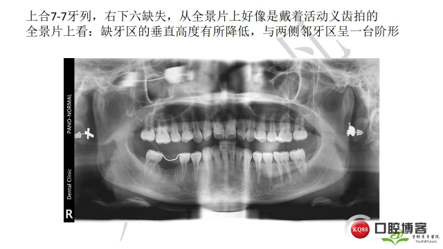 如何避免正畸陷阱！2.jpg_0053.jpg