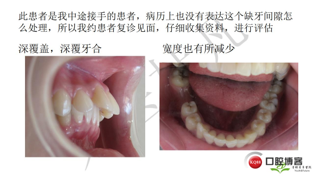 如何避免正畸陷阱！2.jpg_0054.jpg