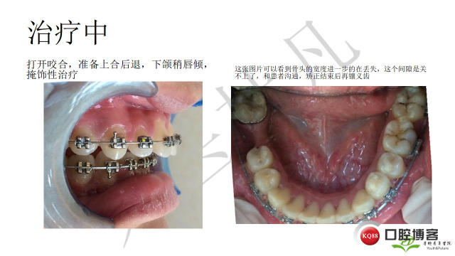 如何避免正畸陷阱！2.jpg_0055.jpg